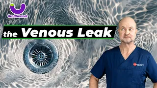 Young men are misdiagnosed all too often with the venous leak! | UroChannel