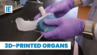 Can 3D Printed Organs Solve the Worldwide Organ Shortage Problem?