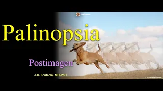 Palinopsia. Postimagen.