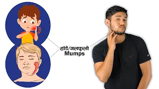 Mumps // गलफुलो / हाँडे  // Nepali Sign Language (NSL)