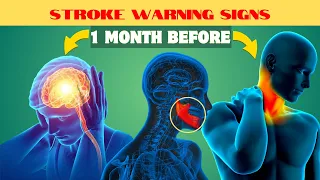 12 Warning Signs of Stroke One Month Before - Unbelievable Signs... Revealed!