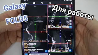 GALAXY FOLD 5. ХОРОШИЙ, НО ЗАЧЕМ ОН МНЕ?