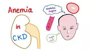 Anemia in Chronic Kidney Disease