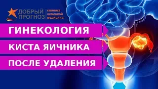 Что делать после УДАЛЕНИЯ КИСТЫ ЯИЧНИКА?