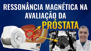 O papel da Ressonância Magnética na avaliação da Próstata