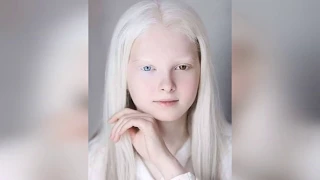 Чеченская школьница-альбинос удивила людей красотой | Chechen girlalbino was surprised by the beauty