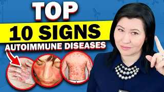 The Top 10 Surprising Signs of Autoimmune Diseases - A Rheumatologist's Guide