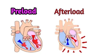 Preload and Afterload