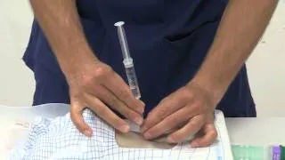 01 Cannula Insertion