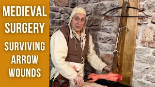 Medieval Surgery | Arrow Removal Techniques