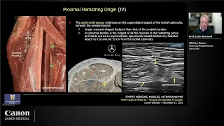 Ultrasound of Hamstring Injuries: What Should We Know and Look At