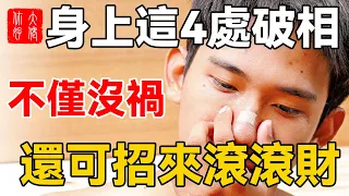 身上這4處破相，不僅無禍，還可招來滾滾財，造福三代人！#大佬你好啊