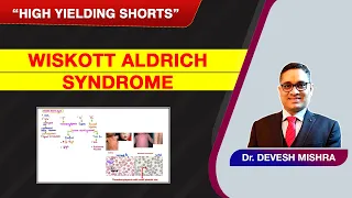 High Yielding Shorts-60 (#HYS-60) : Wiskott Aldrich Syndrome by Dr Devesh Mishra.