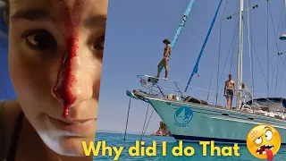 NIGHTMARE at sea WORST injury after 9 years sailing...