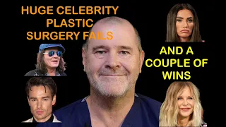 3 Huge Celebrity plastic surgery FAILS. And 2 successes.