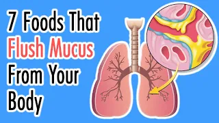 Anti-Mucus Diet: 7 Foods That Flush Mucus From Your Body