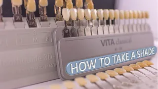 How to take a shade | Image Dental Laboratory