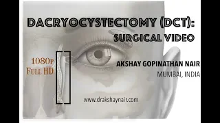 Dacryocystectomy - DCT: Lacrimal Mucocele - surgical video (Full HD)