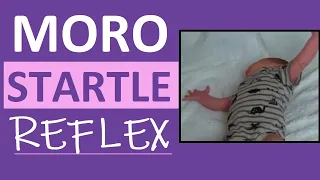 Moro Reflex Newborn Test | Startle Reflex | Pediatric Nursing Assessment