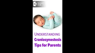 Tips For Parents For A Child With Craniosynostosis - Dr. Vybhav Deraje| Doctors' Circle #shorts