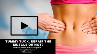 Tummy Tuck, Repair the Muscle or Not? | Ramsey Choucair, M.D. | Dallas, TX | Ph: 214-389-9797