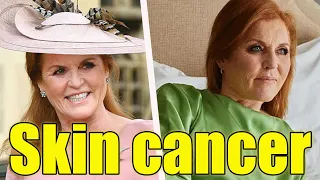 Duchess of York Sarah Ferguson diagnosed with skin cancer