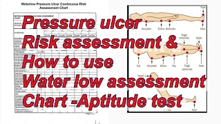 Water low assessment chart -Pressure ulcer risk assessment-#aptitudetestpreparation