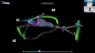 How do you accelerate with Freestyle - Dr. Prins