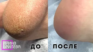 СЕКРЕТ идеального педикюра 🌸 ЧТО и КАК???