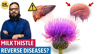 "OONT KATARA" Ka "SAHI" Istamal | Milk Thistle Benefits & Uses | Dr. Ibrahim