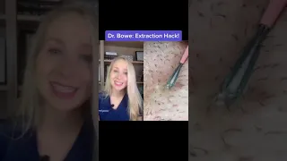 Dr. Whitney Bowe on extraction hack for ingrown #Shorts