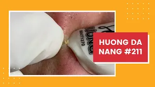 #211 | Huong Da Nang