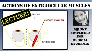 Actions of Extraocular Muscles (Lecture) | Squint Simplified For Medical Students