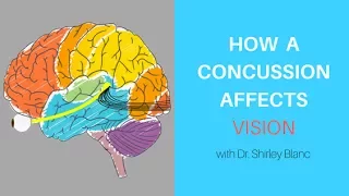 How a concussion affects vision