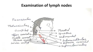 Approach to lymphadenopathy in children | Pediatrics