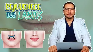 Rejuvenece los labios este 2023 - Dr. Andrés Callejas