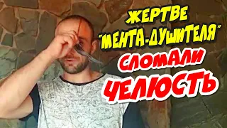 🔥"Прилетела ОБРАТКА ?! Жертве "МЕНТА-ДУШИТЕЛЯ" сломали челюсть после подачи жалобы на сотрудника !"🔥