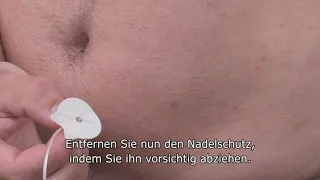 Einführen eines neuen TruSteel™ Infusionssets // t:slim X2™ Insulinpumpe