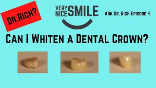 Can I whiten my dental crown?