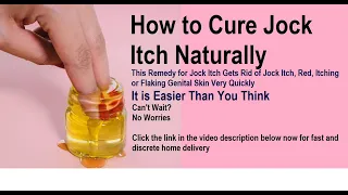 How to Cure Jock Itch Naturally