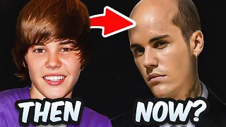 Justin Bieber's Hair Transplant | Surgeon Reacts