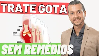 Ácido Úrico Alto DIETA ANTI GOTA Como tratar e reduzir a INFLAMAÇÃO?