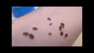 Bed Bugs  What You've Been Told is Totally False,  तिलचट्टे के बारे में, ছারপোকা সম্পর্কে