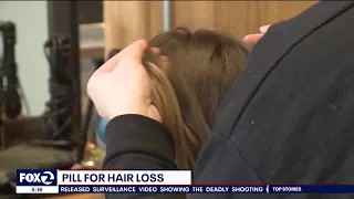 Hair loss helped by blood pressure medication