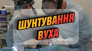 ШУНТИРОВАНИЕ БАРАБАННОЙ ПЕРЕПОНКИ #Shorts