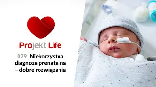 Projekt LIFE 029 - Niekorzystna diagnoza prenatalna - dobre rozwiązania