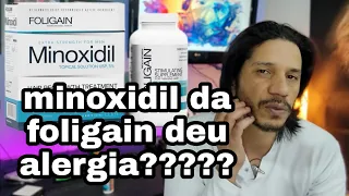 Será que o minoxidil da foligain deu alergia?¿???????