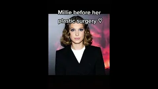Millie Bobby Brown Before Her Plastic Surgery and After #shorts