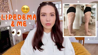 Lipedema and Me ep.1 ad