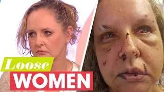 My Husband Brutally Beat Me Until He Thought I Was Dead | Loose Women